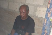 Wajah korban (Onisimus Boimau) babak belur akibat kekerasan yang dilakukan Tersangka Misraim Manggoa.