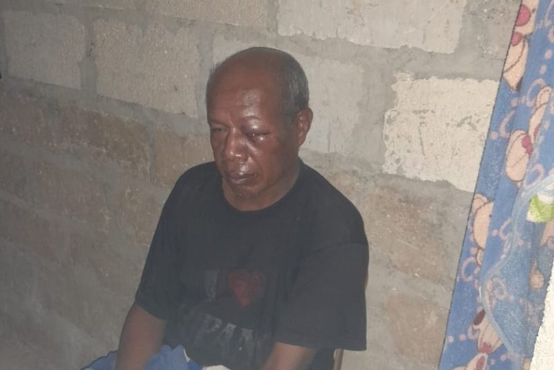 Wajah korban (Onisimus Boimau) babak belur akibat kekerasan yang dilakukan Tersangka Misraim Manggoa.